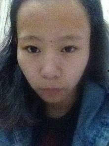 颧骨横张图片,颧骨横张之美学解析